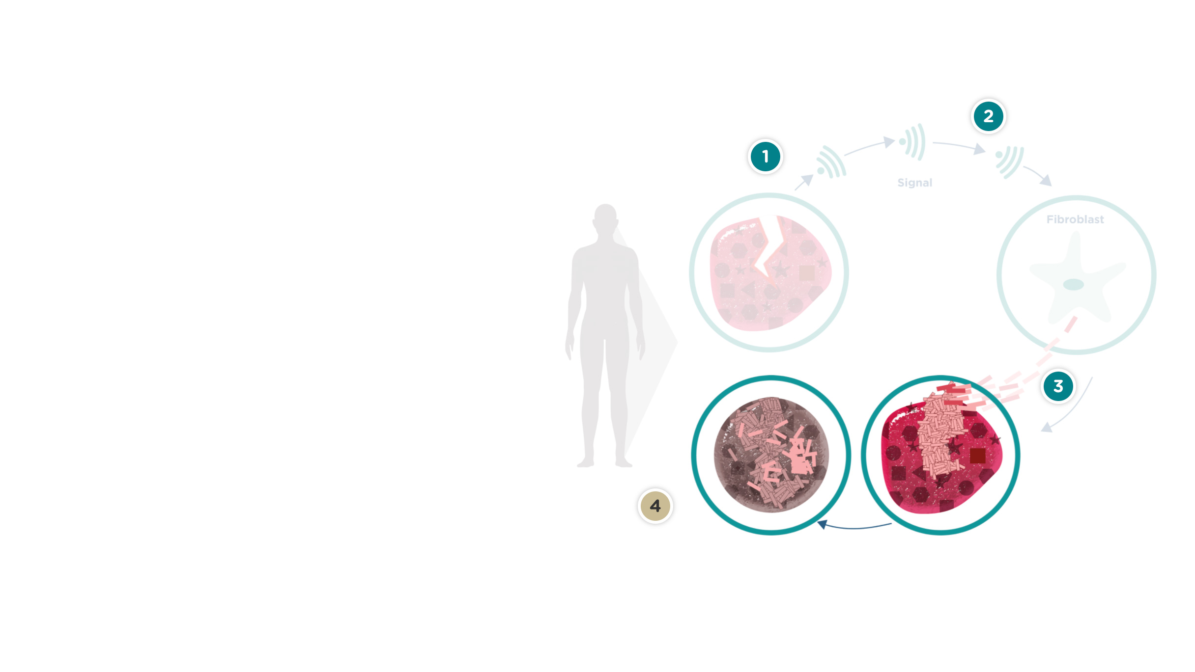 Sağlıklı bireylerde hasar iyileştikçe yara dokusu oluşur. Zamanla, etraftaki dokular iyileştikçe, bu doku da yumuşar