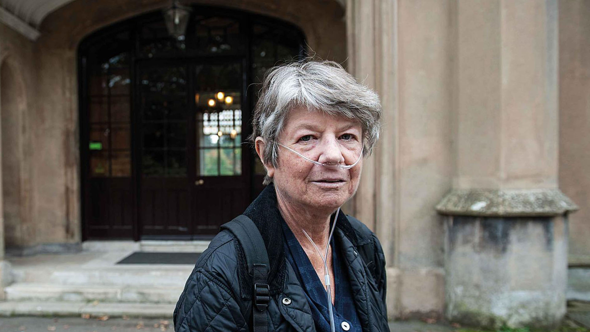 İnterstisyel-akciğer-hastalığı-(İAH)