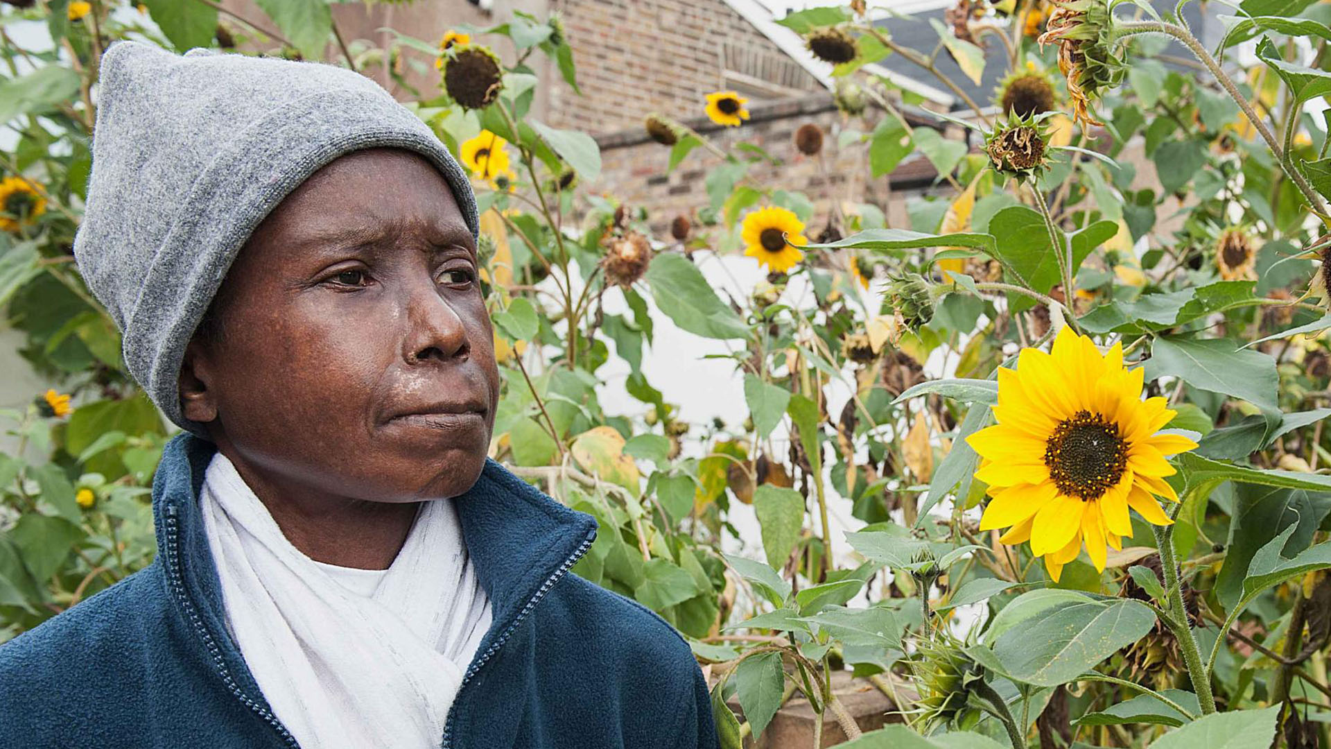 Skleroderma-testleri