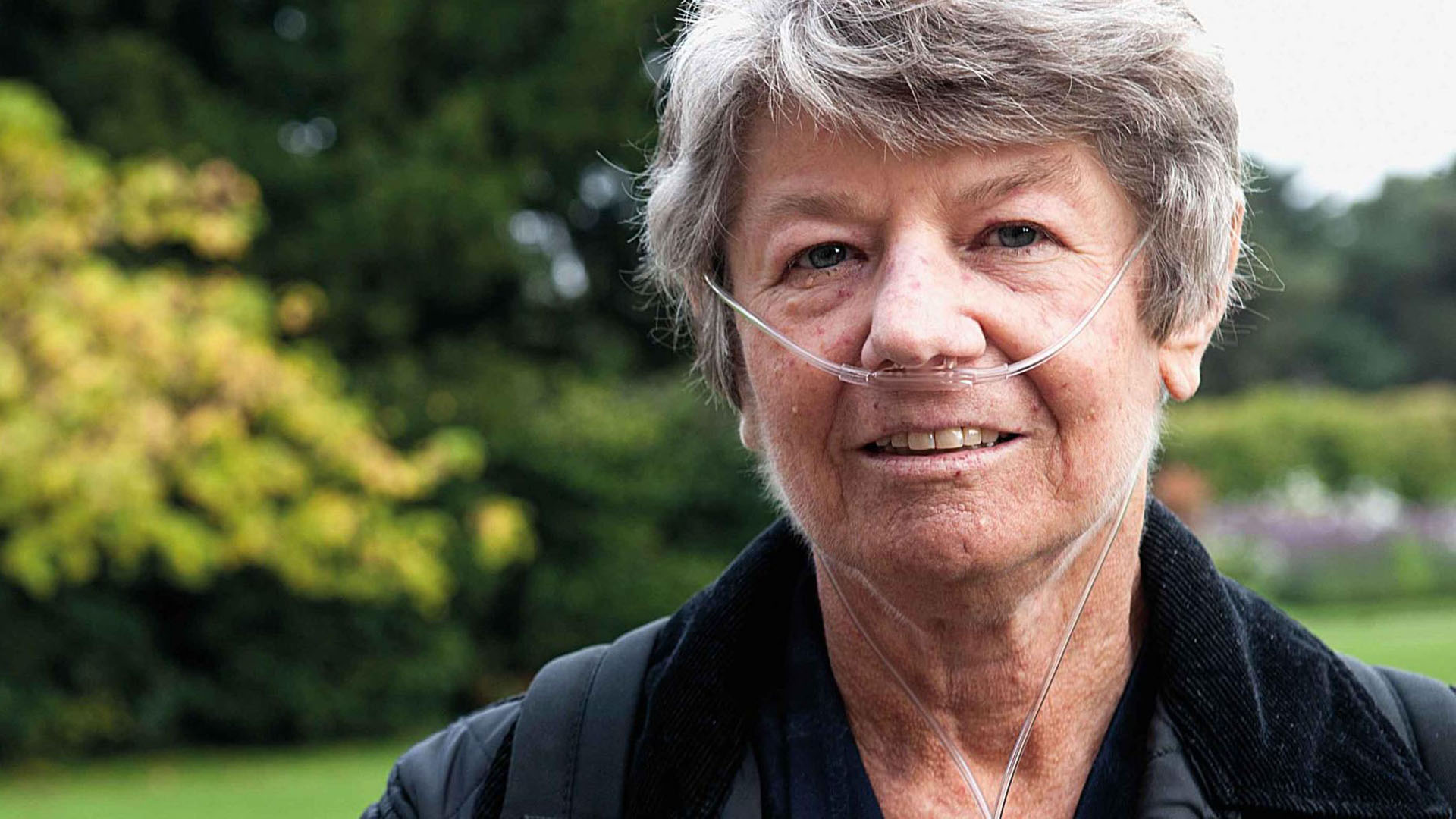 Skleroderma ve akciğer