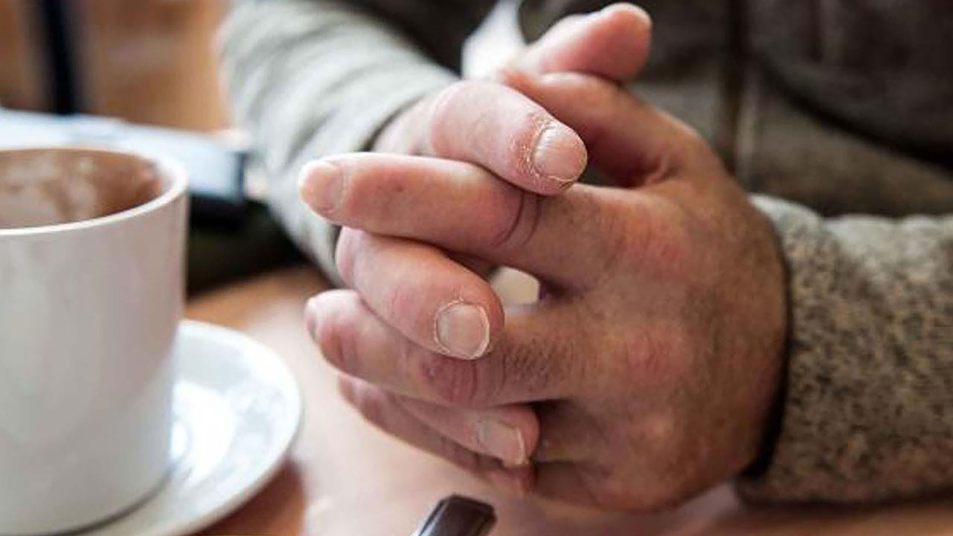 Ellerde-ve-parmaklarda-şişme