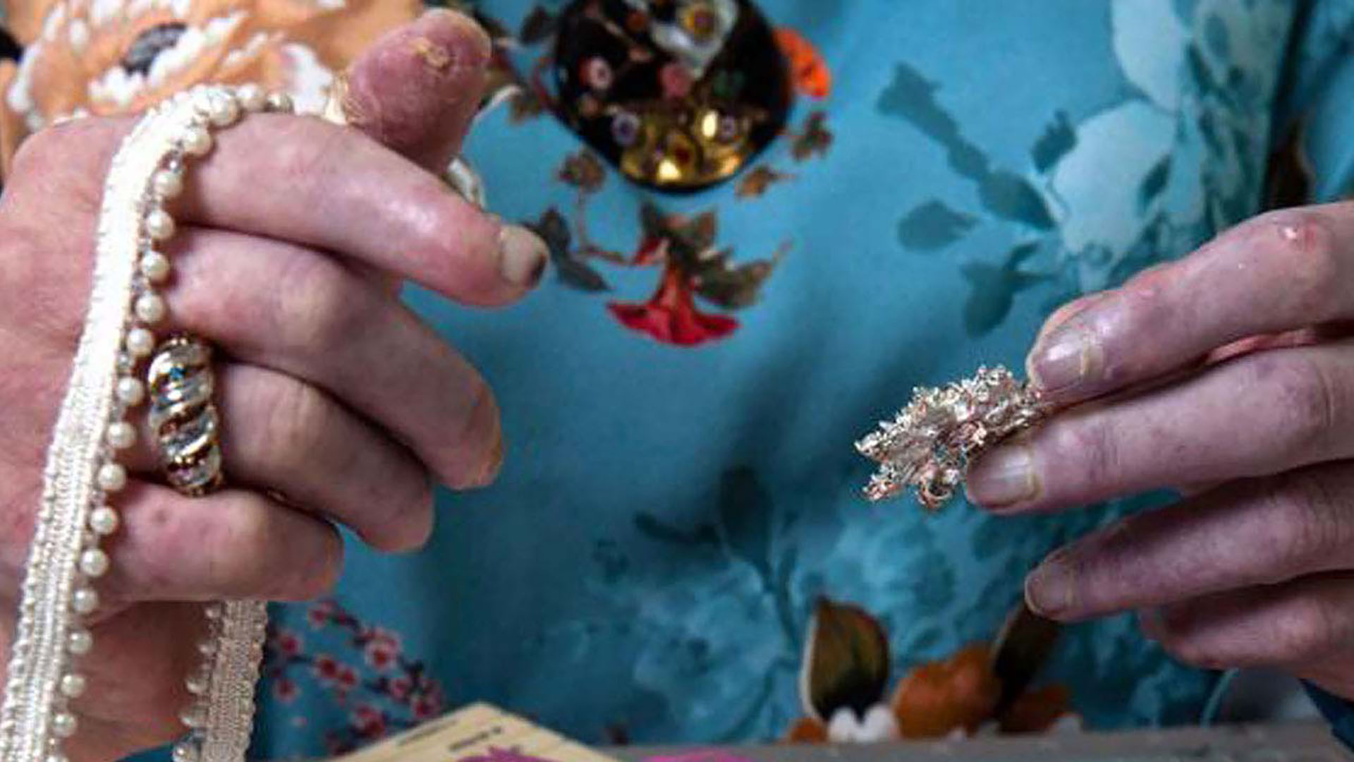 Ülserler-veya-açık-yaralar