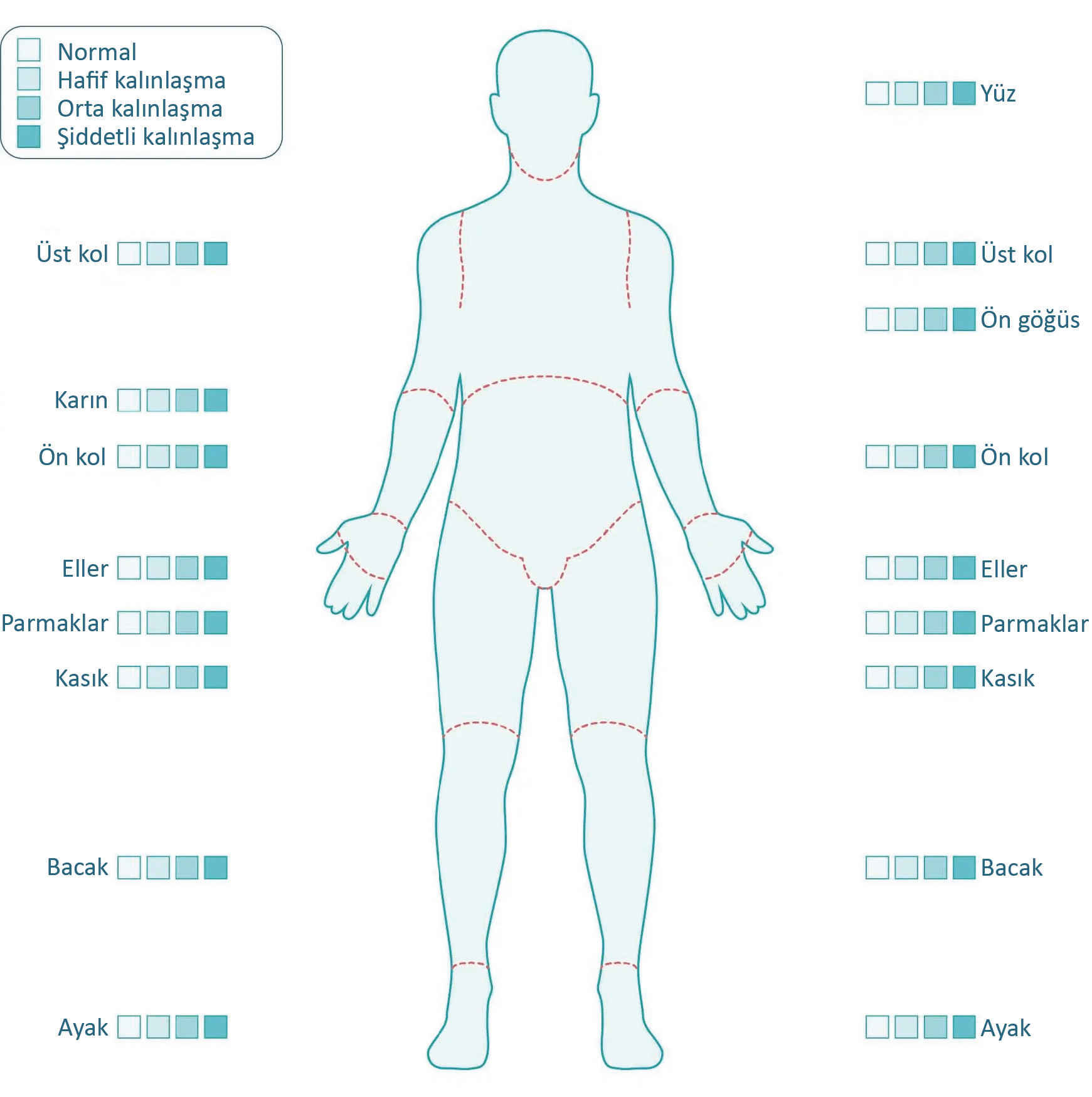2-3-5-modified_rodnan_skin_thickness_score_diagram-01_0
